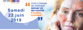 La dermatite atopique